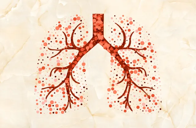 Celebrating 25 years of the Olmsted County Tuberculosis Clinic 